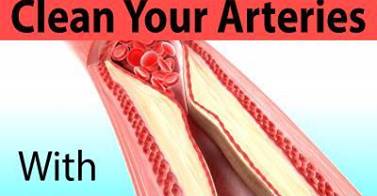 clean_your_arteries clean_your_arteries